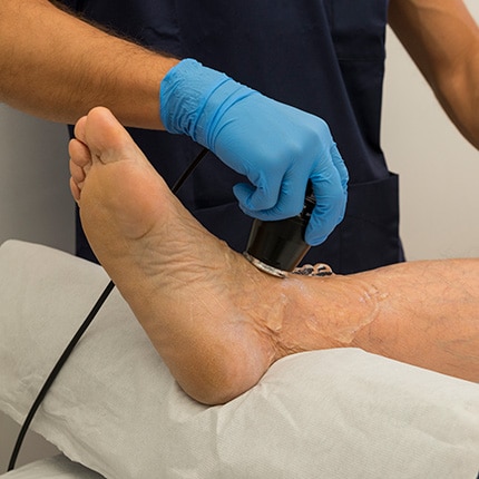 Doctor with gloves applying ultrasound to ankle